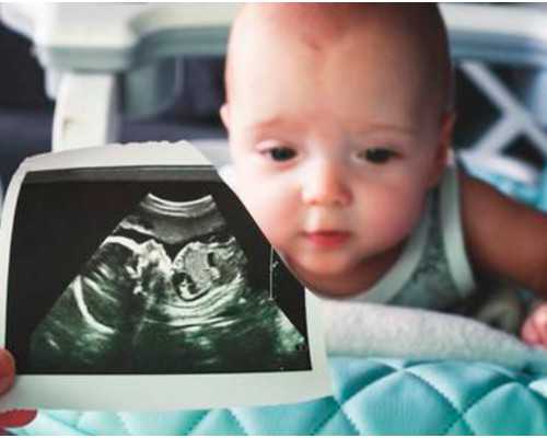 试管婴儿流程时间详解及费用成功率分析