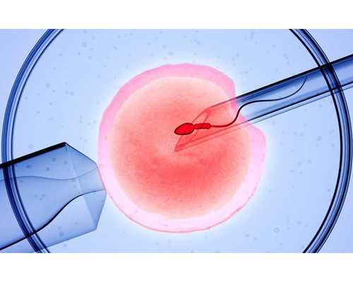 三代试管选Y染色体与胎停应对，供精试管条件详解
