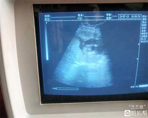 台湾代孕合法吗：孕期胡思乱想、担忧胎儿畸形