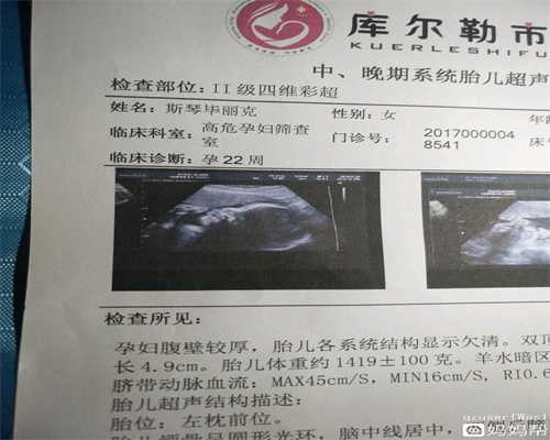深圳代孕需要多少钱,备孕的正确姿势