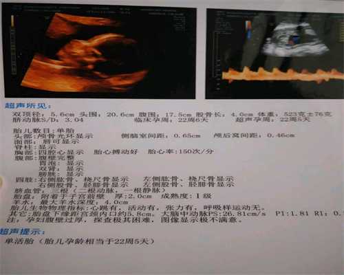 深圳第三代助孕,备孕期间饮食很重要这几种食物