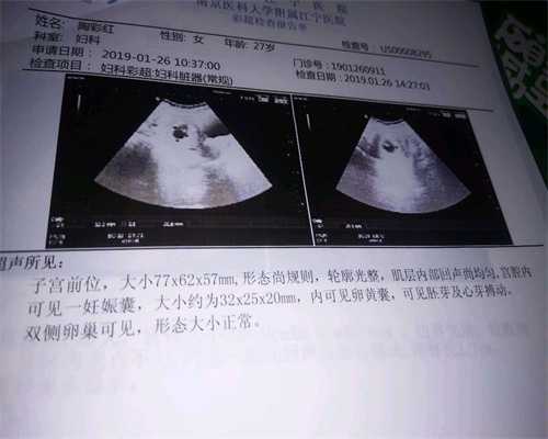 深圳代孕捐卵,孕期胎盘低置不要怕，只要28周前