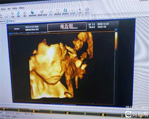 北京五洲医院科普一次人流后月经量少了，身体