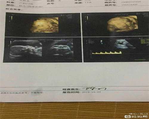 深圳代孕包成功套餐,一个孕五周接胎心，一个八